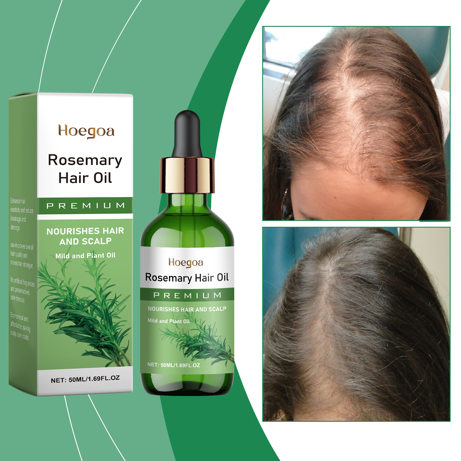 Rosemary Hair Oil - Rosemary Hair Essential Oil Scalp Hair