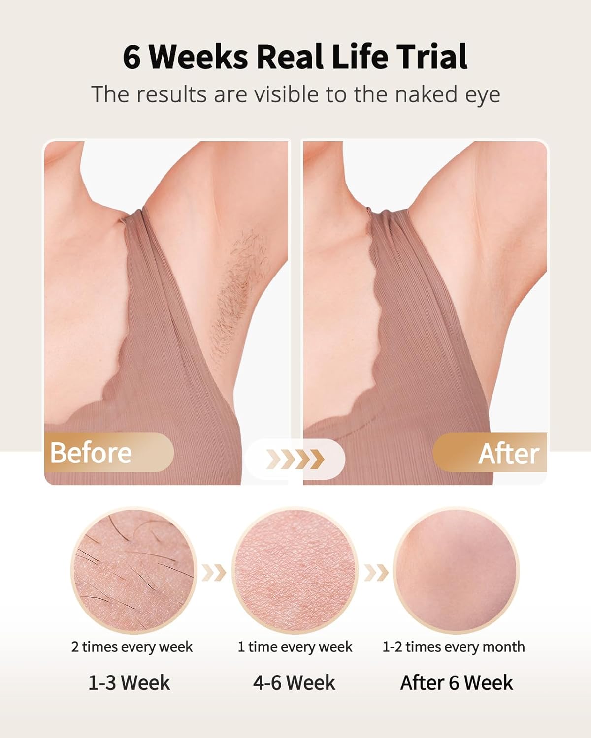 Laser Hair Removal with Ice Co – Hair Care Or Haircare Bewertung und Preis