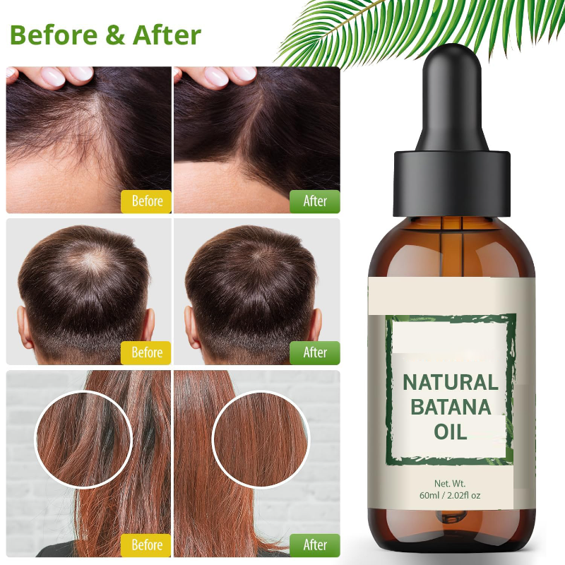 Rosemary Hair Essential Oil No – Rosemary Hair Oil Bewertung und Preis
