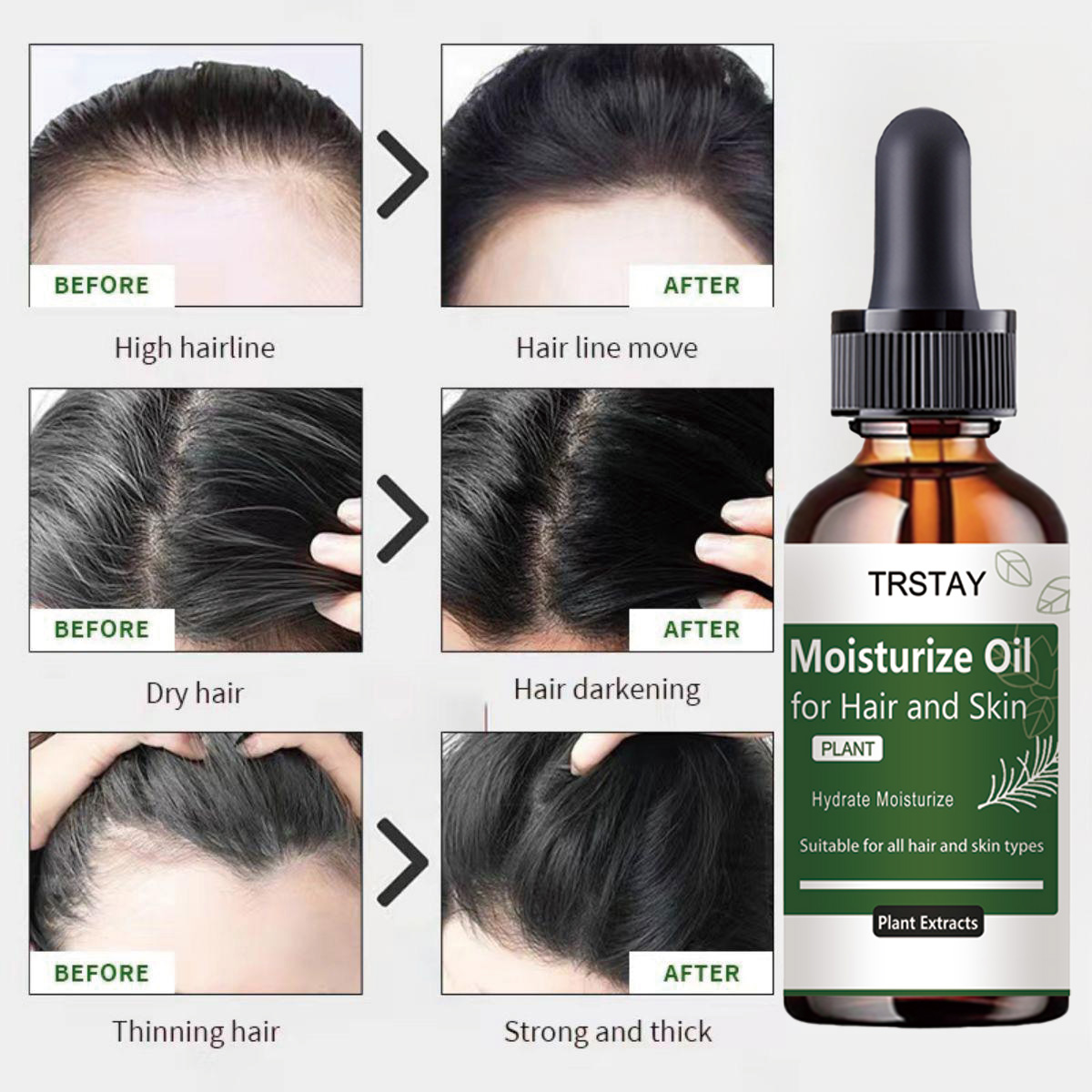 TRSTAY Rosemary Essential Oil  – Rosemary Hair Oil Bewertung und Preis