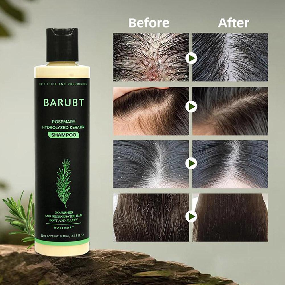 Rosemary Shampoo Hair Growth D – Rosemary Hair Oil Bewertung und Preis