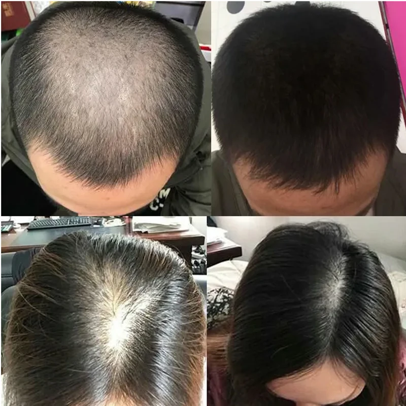 Overlord plant hair growth liq – Hair Care Or Haircare Bewertung und Preis