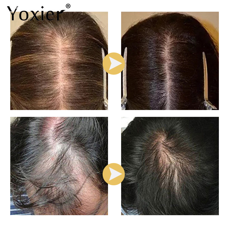Intensive Growth Serum Prevent – Hair Care For Hair Loss Bewertung und Preis