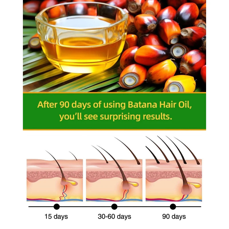 Batana Rosemary Hair Care Esse – Rosemary Hair Oil Bewertung und Preis