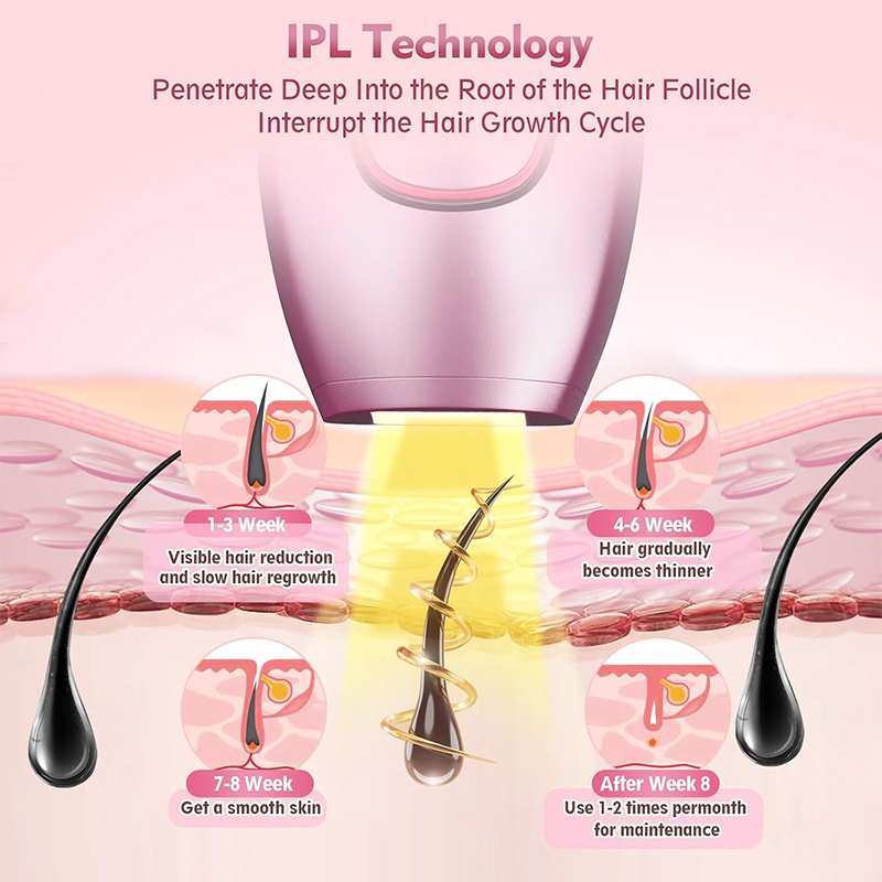 IPL laser Hair Remover Hair Cu – Hair Care Or Haircare Bewertung und Preis