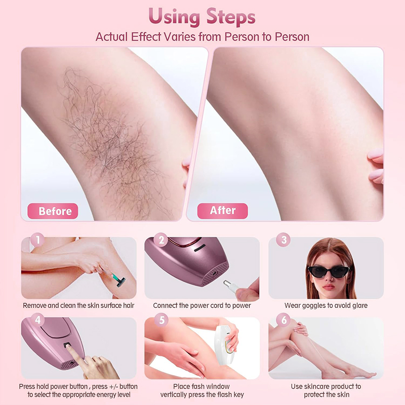 IPL laser Hair Remover Hair Cu – Hair Care Or Haircare Bewertung und Preis