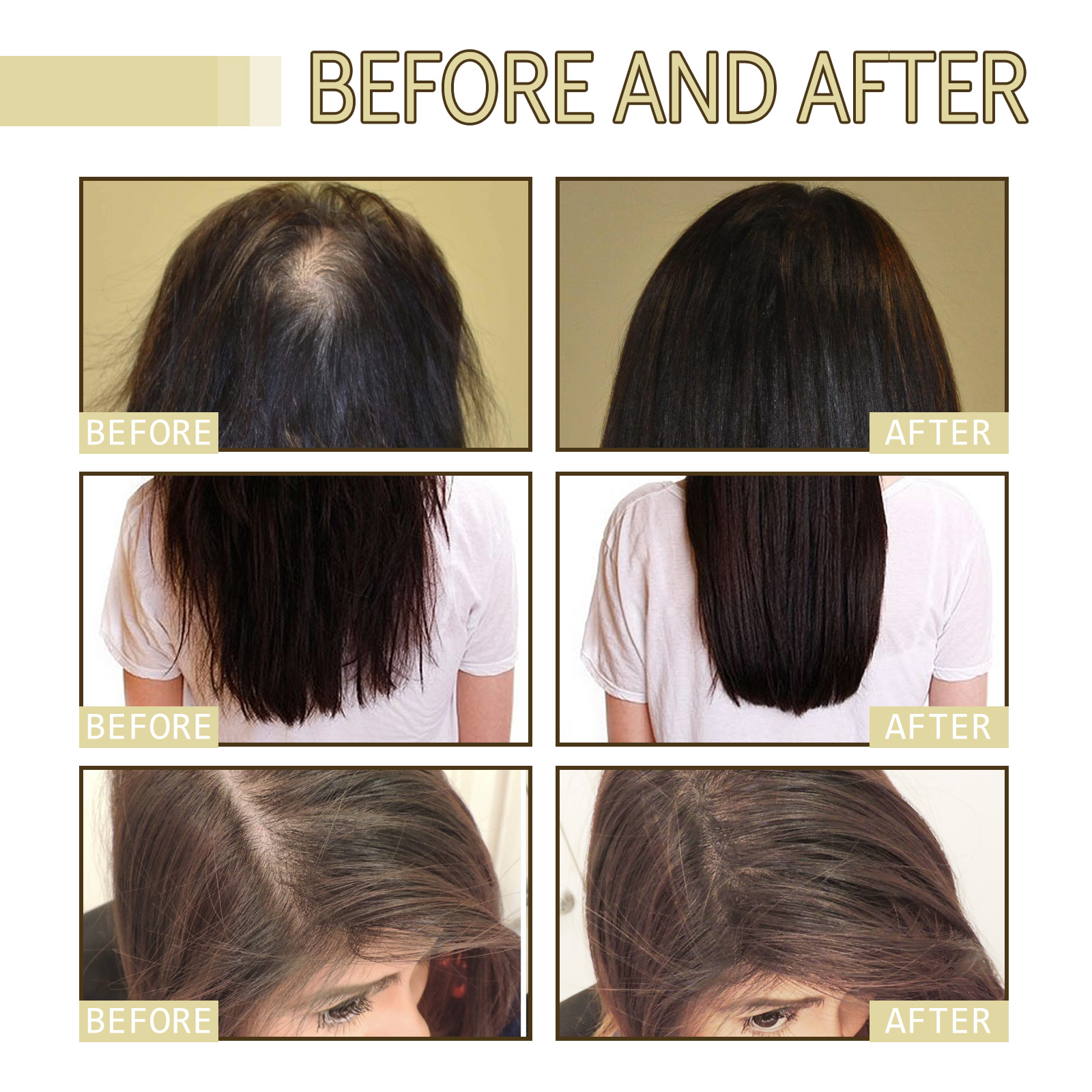 Rosemary Hair Growth Oil 60ml  – Hair Care For Hair Loss Bewertung und Preis