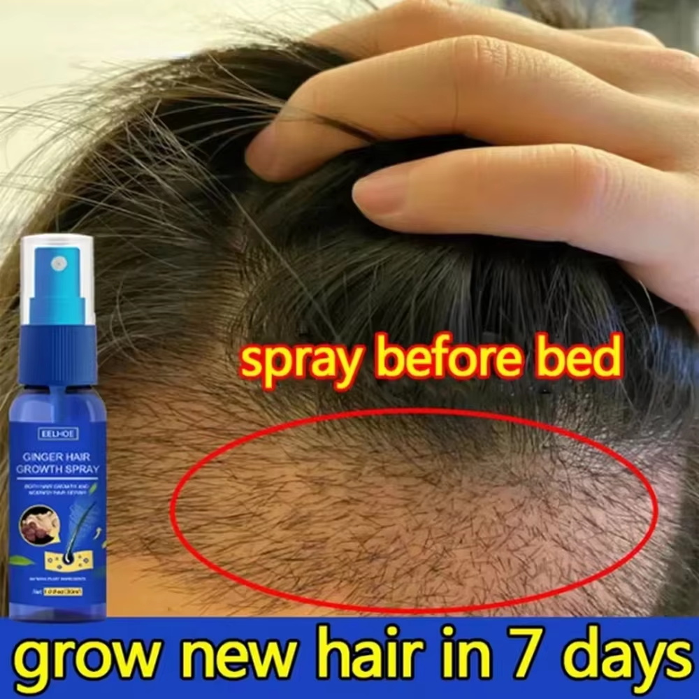 Ginger Hair Growth spray Anti  – Hair Care For Hair Loss Bewertung und Preis