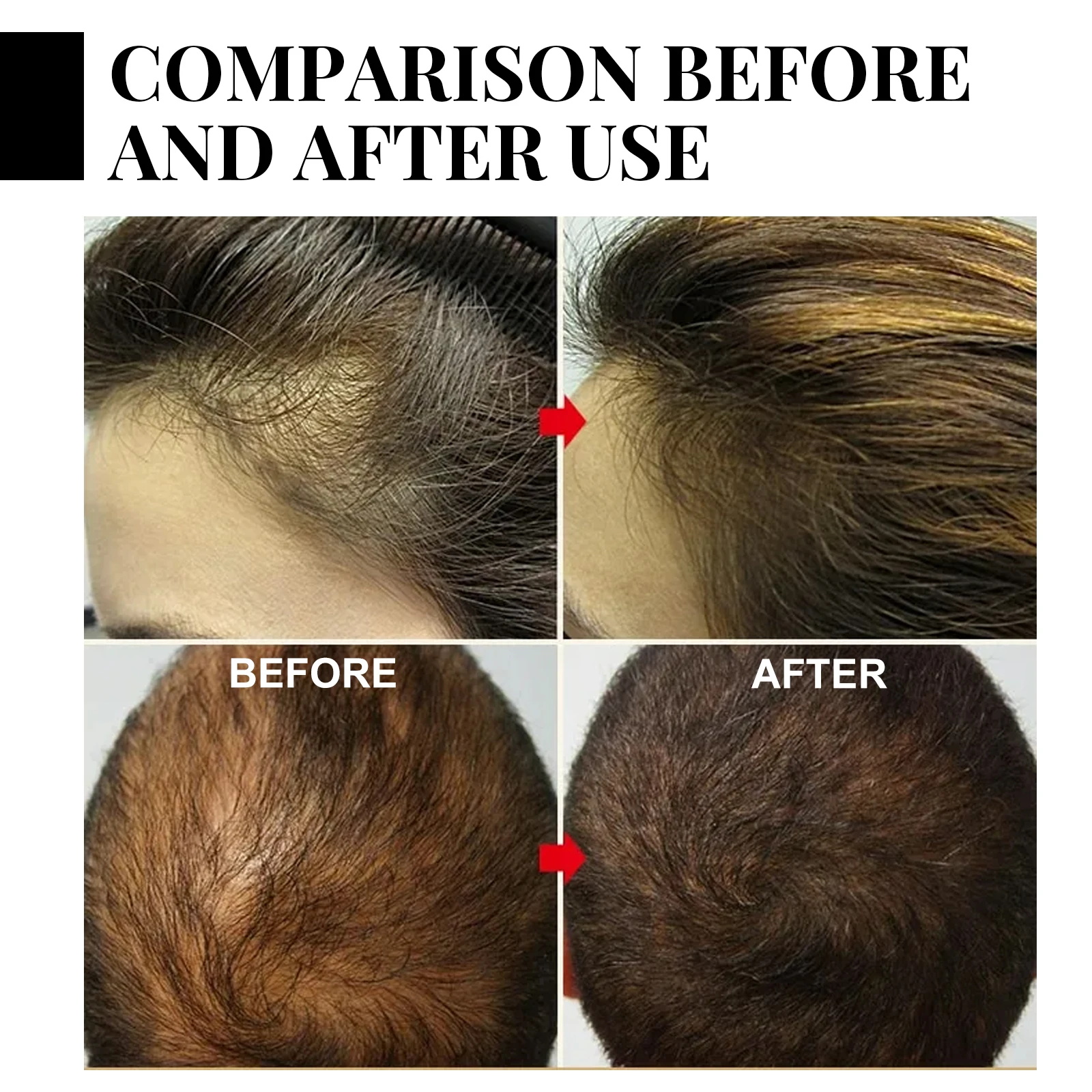 Ginger Hair Growth spray Anti  – Hair Care For Hair Loss Bewertung und Preis