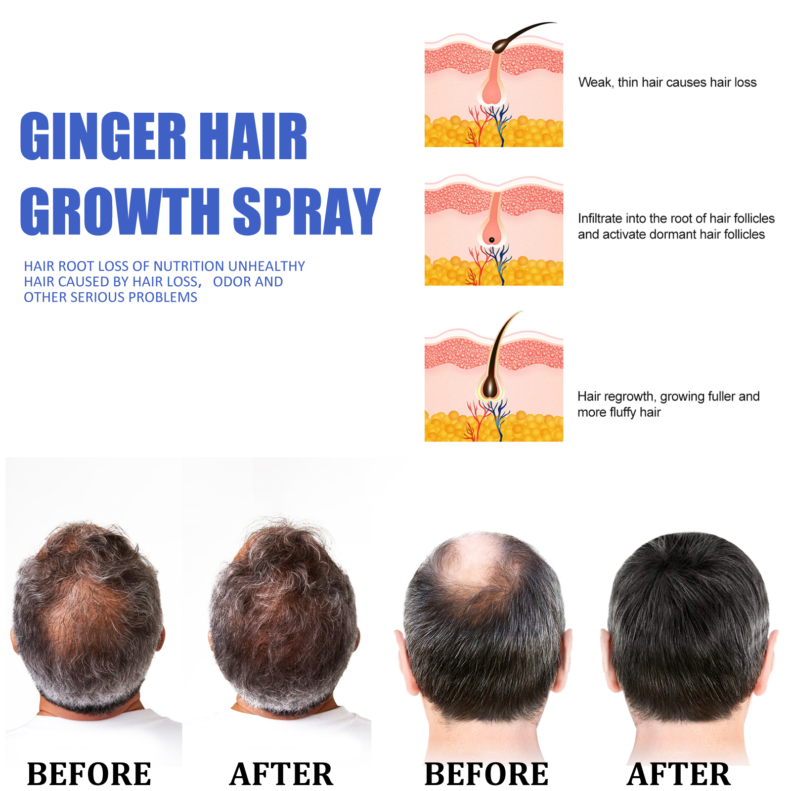 Ginger Hair Growth spray Anti  – Hair Care For Hair Loss Bewertung und Preis