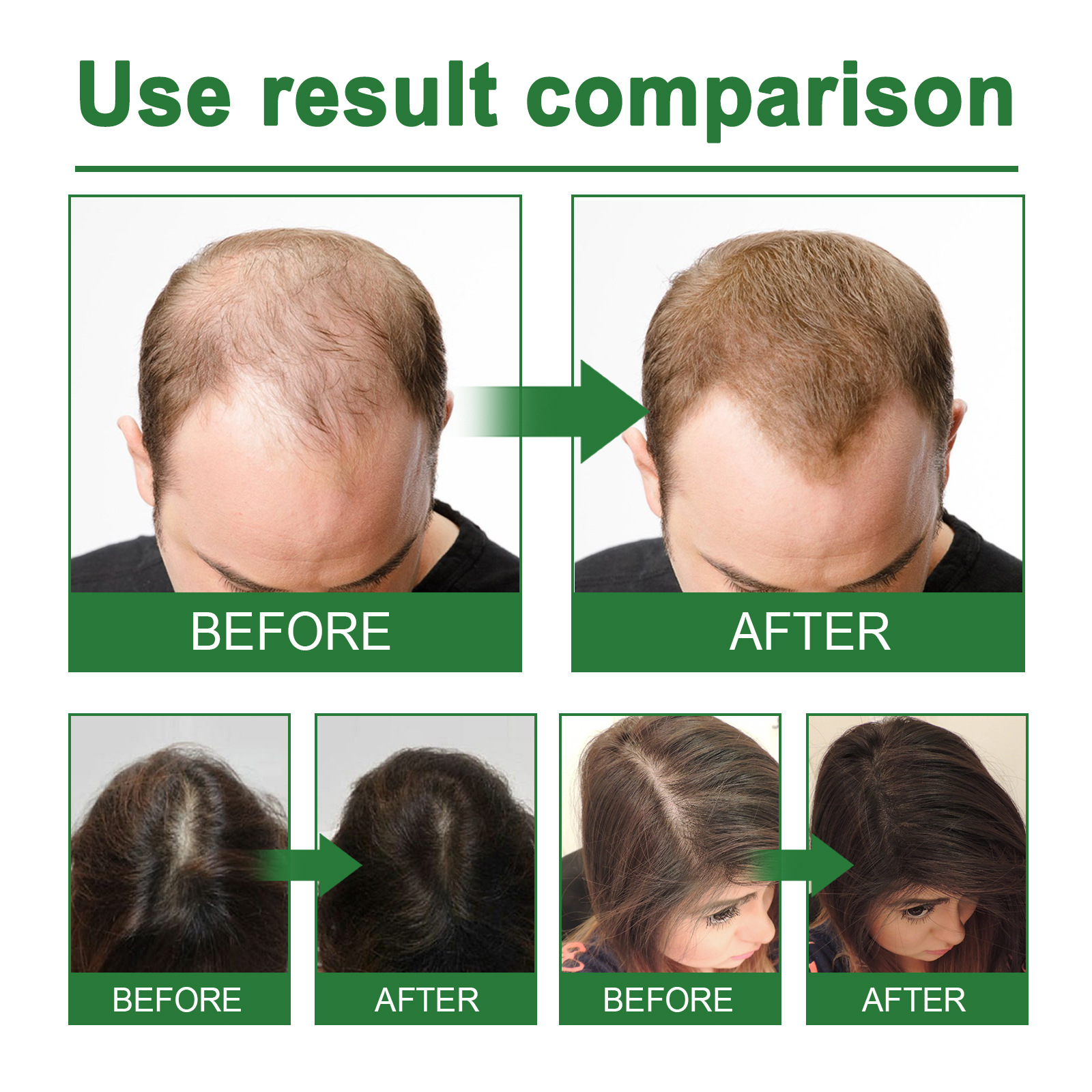 Rosemary Spray for Hair Nouris – Hair Care For Hair Loss Bewertung und Preis