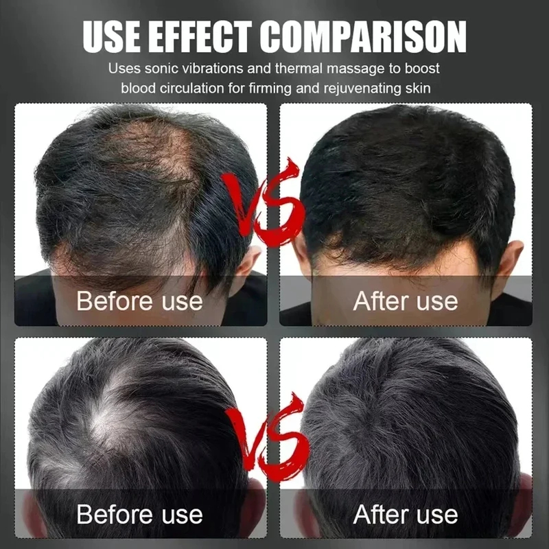 660nm 850nm Red Light Infrared – Hair Care For Hair Loss Bewertung und Preis